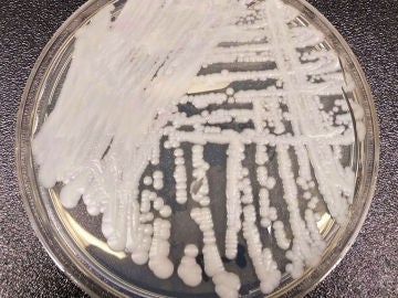 El hongo 'Candida auris' cultivado en los Centros para el Control y la prevención de Enfermedades (CDC)