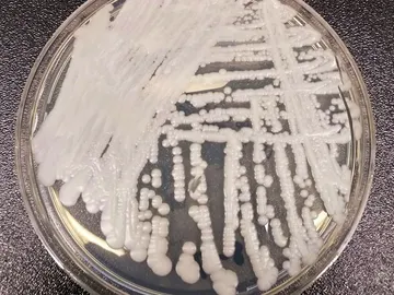 El hongo 'Candida auris' cultivado en los Centros para el Control y la prevención de Enfermedades (CDC) El hongo 'Candida auris' cultivado en los Centros para el Control y la prevención de Enfermedades (CDC)
