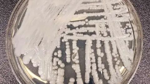 El hongo 'Candida auris' cultivado en los Centros para el Control y la prevención de Enfermedades (CDC) El hongo 'Candida auris' cultivado en los Centros para el Control y la prevención de Enfermedades (CDC)