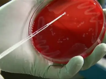 Investigadores españoles diseñan antibióticos que atacan solo las bacterias 'malas' y evitan resistencias Investigadores españoles diseñan antibióticos que atacan solo las bacterias 'malas' y evitan resistencias