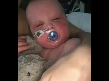 Comparte imágenes de su bebé con sarampión para concienciar sobre la importancia de las vacunas Comparte imágenes de su bebé con sarampión para concienciar sobre la importancia de las vacunas