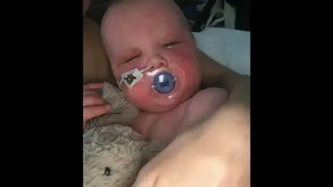 Comparte imágenes de su bebé con sarampión para concienciar sobre la importancia de las vacunas Comparte imágenes de su bebé con sarampión para concienciar sobre la importancia de las vacunas