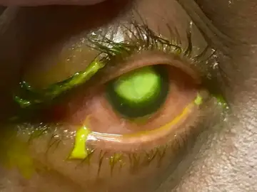 Las consecuencias de dormir con lentillas Las consecuencias de dormir con lentillas
