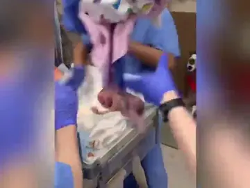 Momento de la caída del bebé Momento de la caída del bebé