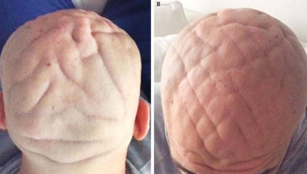 El hombre con unos surcos con forma de cerebro en la cabeza