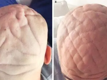 El hombre con unos surcos con forma de cerebro en la cabeza El hombre con unos surcos con forma de cerebro en la cabeza