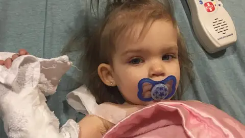 Callie June, una bebé de 18 meses enferma de cáncer Callie June, una bebé de 18 meses enferma de cáncer