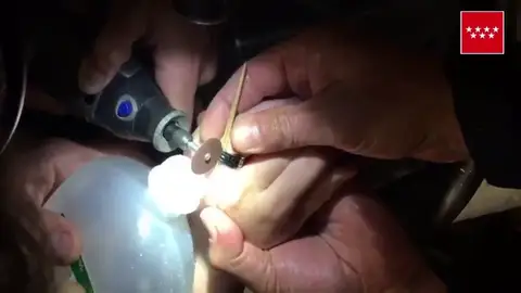 Los bomberos de la Comunidad de Madrid intervienen para quitarle un anillo a una adolescente Los bomberos de la Comunidad de Madrid intervienen para quitarle un anillo a una adolescente
