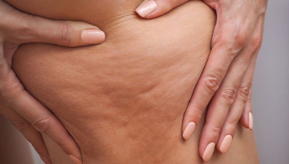 Acabar con la celulitis de las piernas