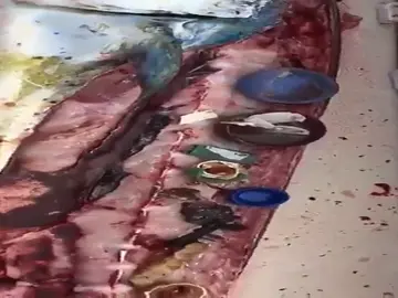 El impactante vídeo donde un hombre abre un pescado y extrae todo tipo de plásticos de su interior El impactante vídeo donde un hombre abre un pescado y extrae todo tipo de plásticos de su interior