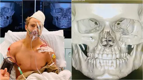 Sage Northcutt, en el hospital tras su brutal ko Sage Northcutt, en el hospital tras su brutal ko