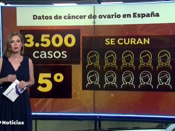 Las claves para detectar el cáncer de ovario Las claves para detectar el cáncer de ovario