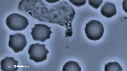 La amenaza de las bacterias superresistentes a los antibióticos La amenaza de las bacterias superresistentes a los antibióticos