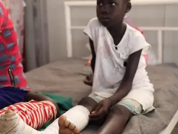 Cinco millones y medio de personas son mordidas por serpientes en el mundo Cinco millones y medio de personas son mordidas por serpientes en el mundo