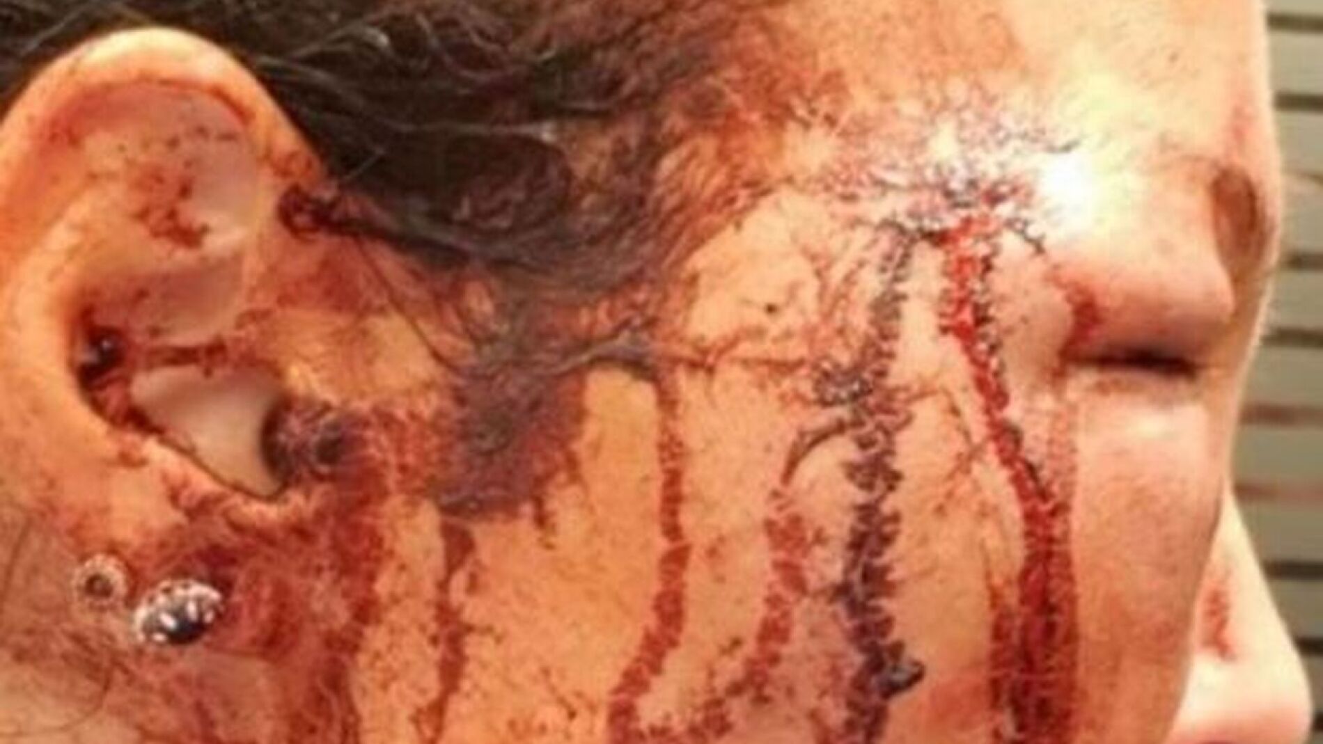 Manto Tzavaras ense&ntilde;a la presunta agresi&oacute;n de Papamakarios