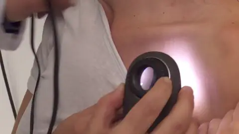 ¿Cómo funciona un dermatoscopio? ¿Cómo funciona un dermatoscopio?
