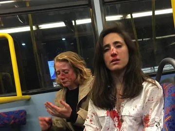 La pareja tras la agresión La pareja tras la agresión