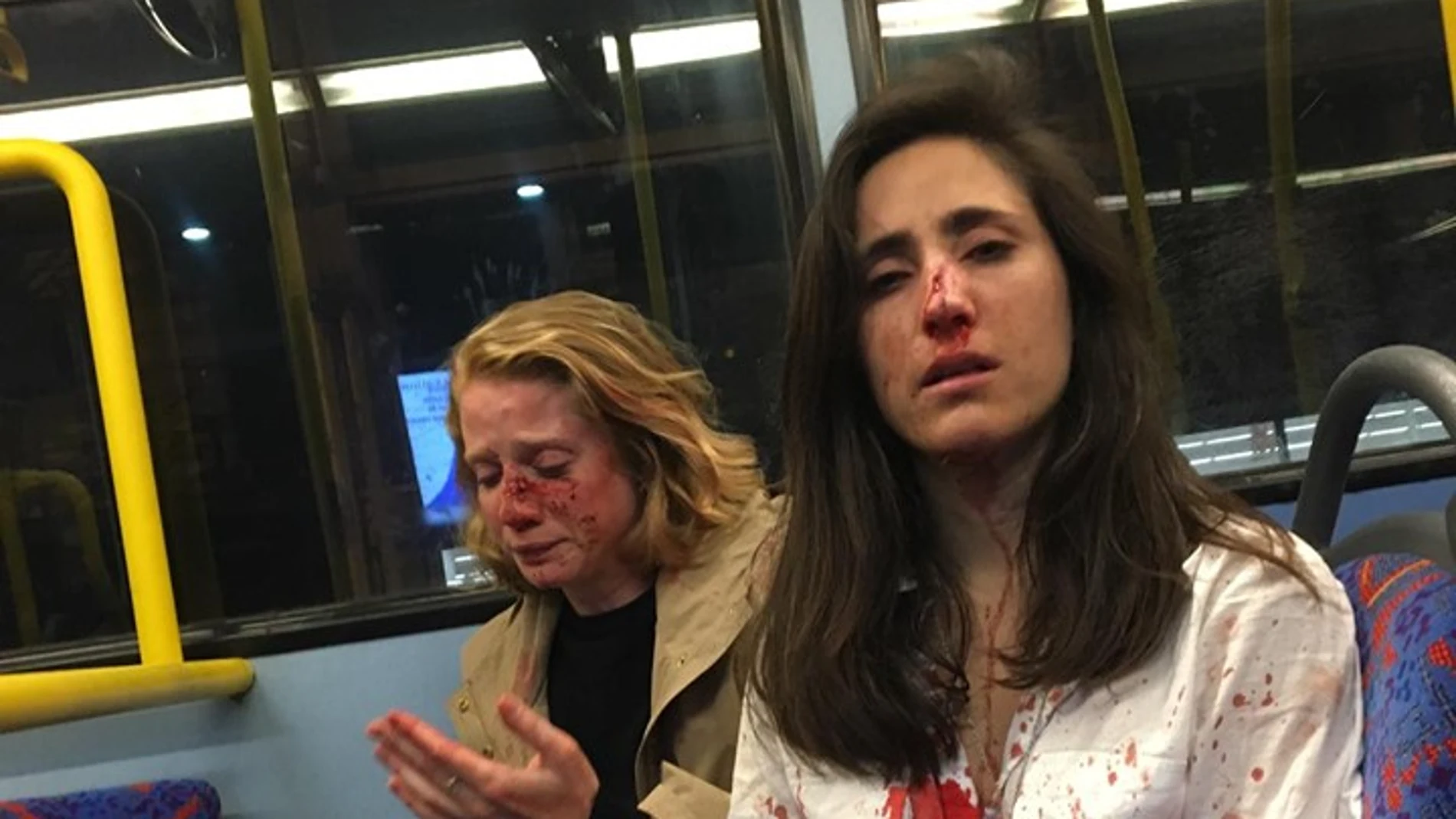 La pareja tras la agresión La pareja tras la agresión