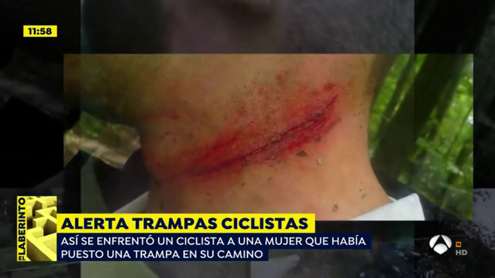 Trampas para ciclistas.