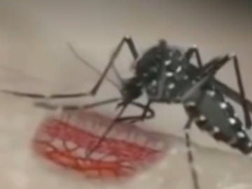 El mosquito tigre puede transmitir el virus chikungunya, dengue y zika.