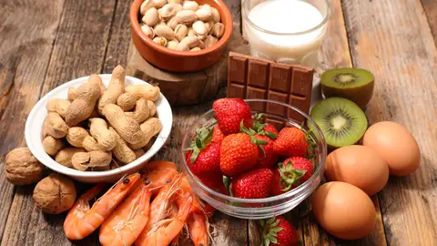 Alimentos Alimentos