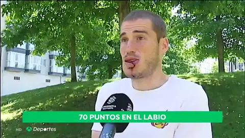 Bergantiños comienza a sangrar en plena entrevista: recibió 70 puntos de sutura en la cara Bergantiños comienza a sangrar en plena entrevista: recibió 70 puntos de sutura en la cara