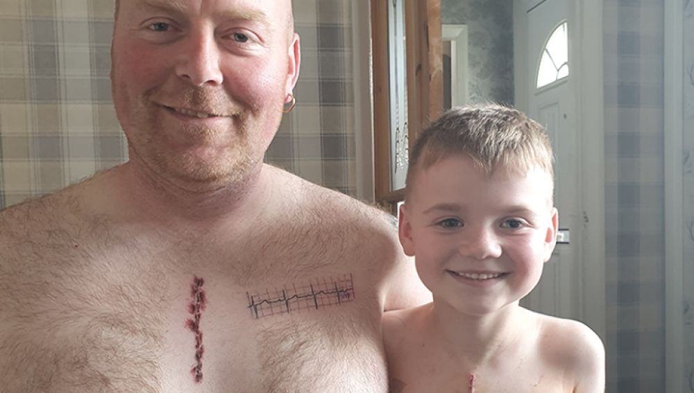 Padre e hijo con sus cicatrices