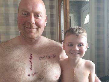 Padre e hijo con sus cicatrices