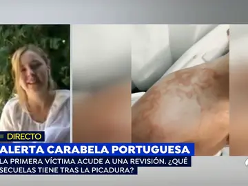 Carabela portuguesa. Carabela portuguesa.