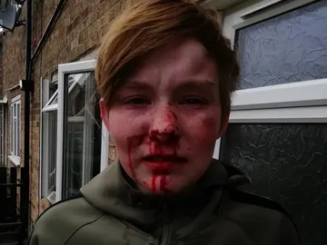 Ellie-Mae Mulholland, la joven de 18 años que fue agredida Ellie-Mae Mulholland, la joven de 18 años que fue agredida