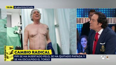El impresionante cambio de Pipi Estrada tras su operación estética: 