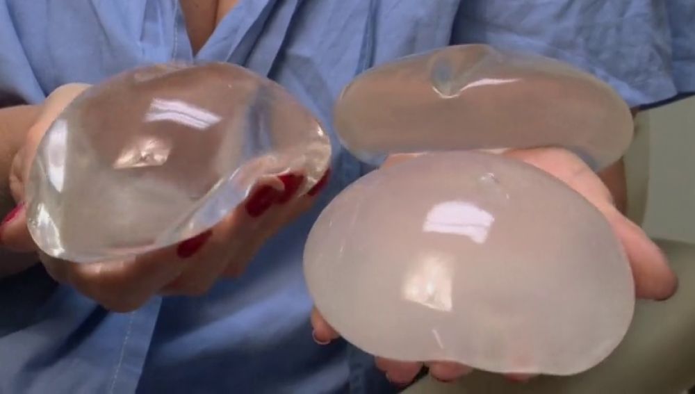 Suspenden la venta de algunos implantes de pecho en Estados Unidos
