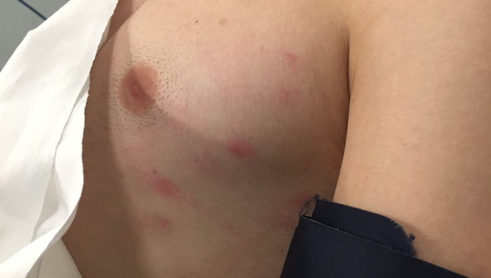 Denuncian una agresión homófoba en Murcia