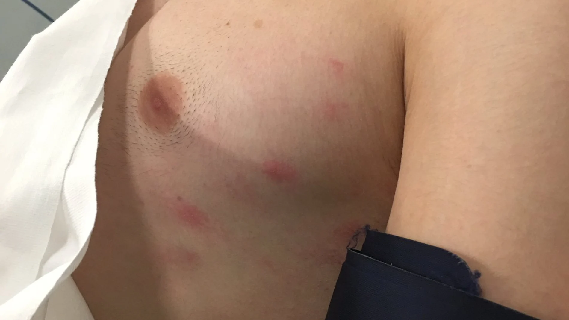Denuncian una agresión homófoba en Murcia Denuncian una agresión homófoba en Murcia