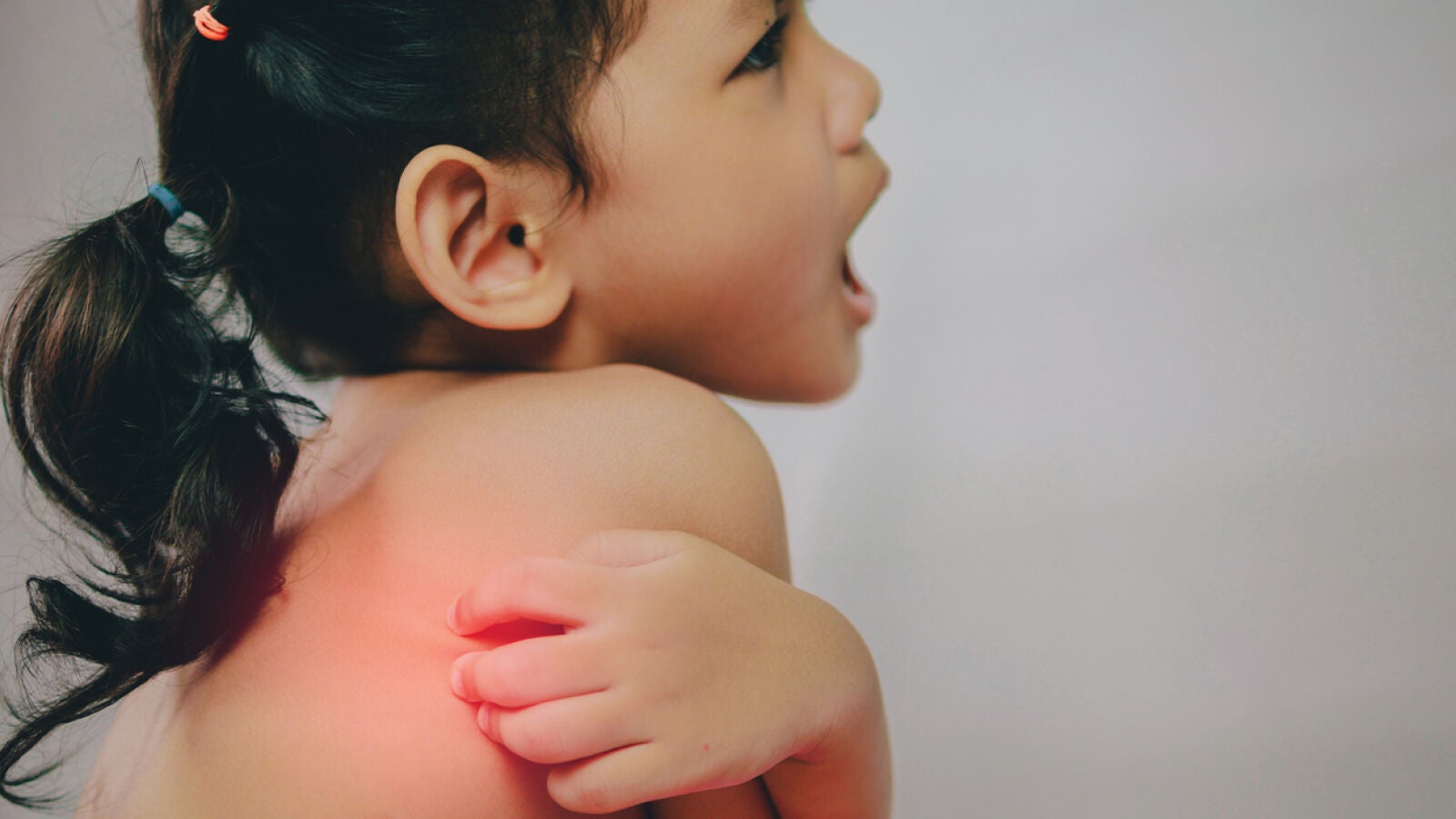 Niños y picaduras de insectos, ¿qué debes saber?