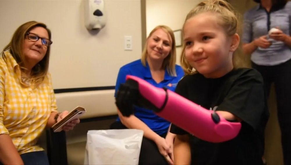 Una niña de ocho años, la persona más joven de Estados Unidos en recibir un brazo biónico