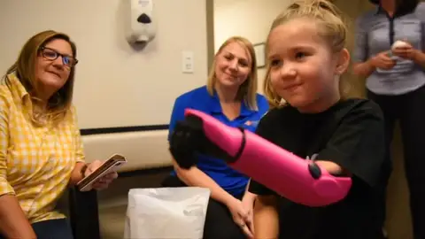 Una niña de ocho años, la persona más joven de Estados Unidos en recibir un brazo biónico Una niña de ocho años, la persona más joven de Estados Unidos en recibir un brazo biónico