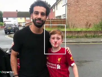 El aplaudido gesto de Salah con un niño que se rompió la nariz al pedirle una foto El aplaudido gesto de Salah con un niño que se rompió la nariz al pedirle una foto