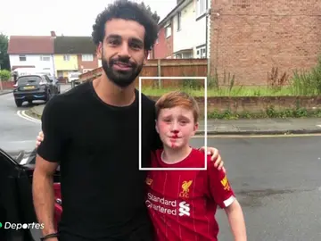 El aplaudido gesto de Salah con un niño que se rompió la nariz al pedirle una foto El aplaudido gesto de Salah con un niño que se rompió la nariz al pedirle una foto