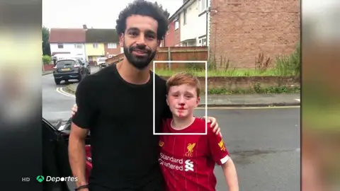 El aplaudido gesto de Salah con un niño que se rompió la nariz al pedirle una foto El aplaudido gesto de Salah con un niño que se rompió la nariz al pedirle una foto