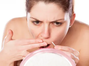 Depilación del bigote Depilación del bigote