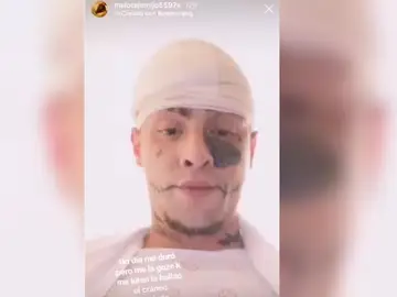 El joven con la cabeza vendada El joven con la cabeza vendada