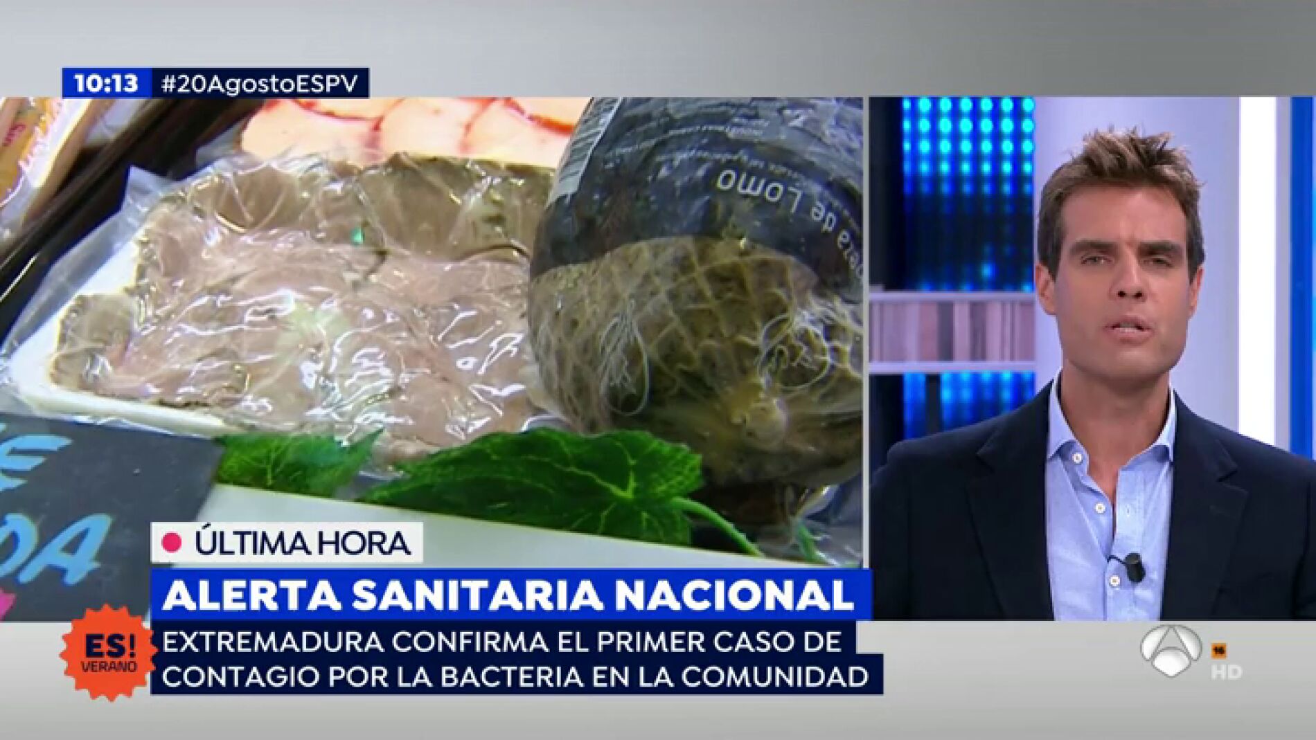 Toda la familia de un hombre contaminada, salvo &eacute;l, por consumir carne mechada contaminada: "Lo puedo estar incubando, tengo que esperar"
