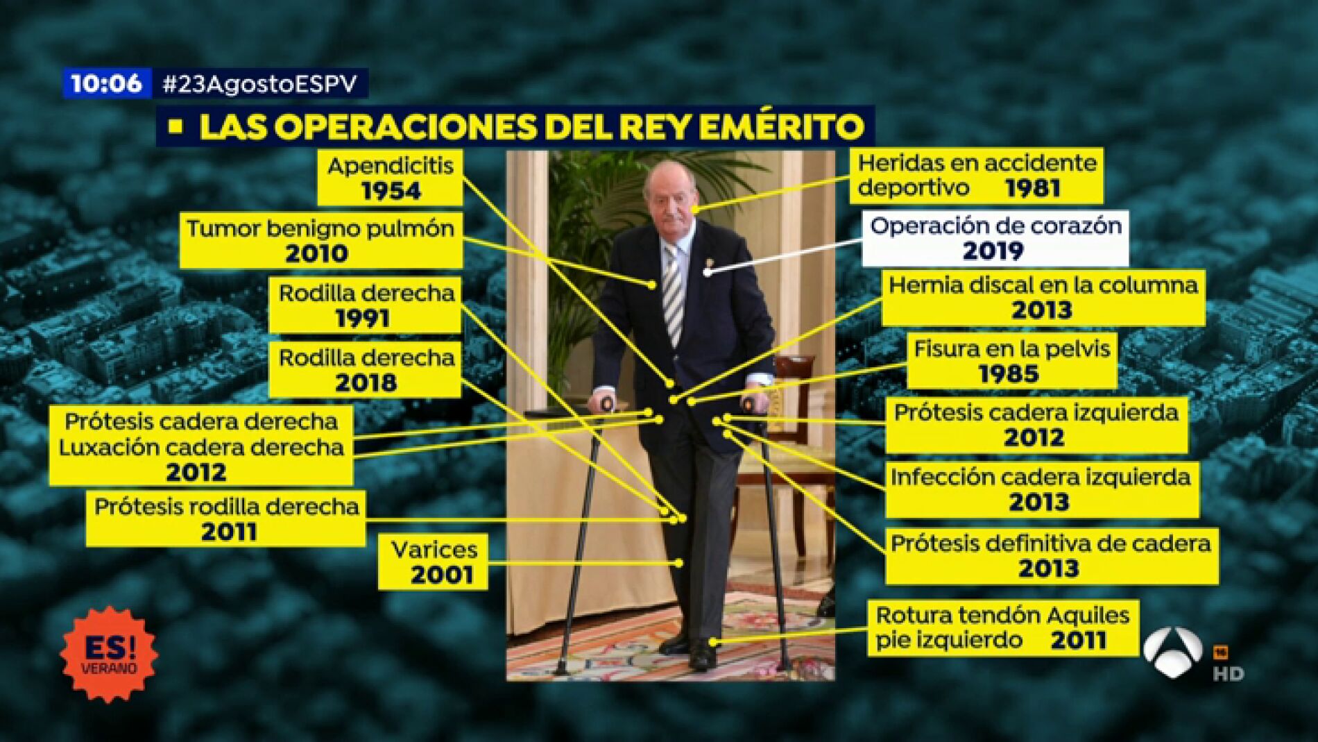 La operaci&oacute;n de coraz&oacute;n del Rey em&eacute;rito