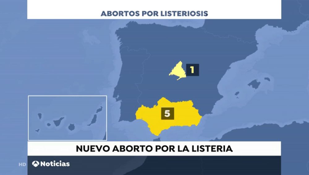 La Junta anuncia la administración de antibióticos a las embarazadas asintomáticas que consumieron carne mechada tras un nuevo aborto