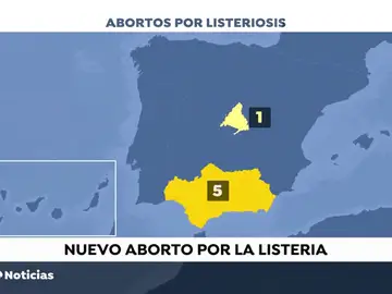 La Junta anuncia la administración de antibióticos a las embarazadas asintomáticas que consumieron carne mechada tras un nuevo aborto La Junta anuncia la administración de antibióticos a las embarazadas asintomáticas que consumieron carne mechada tras un nuevo aborto