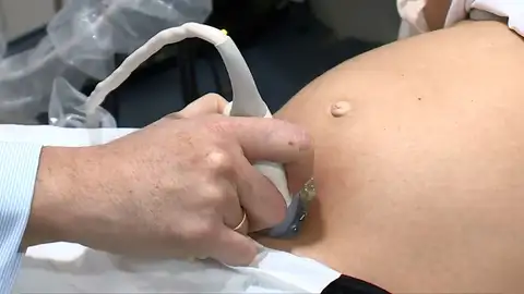 Seis mujeres abortan por el brote de listeria Seis mujeres abortan por el brote de listeria