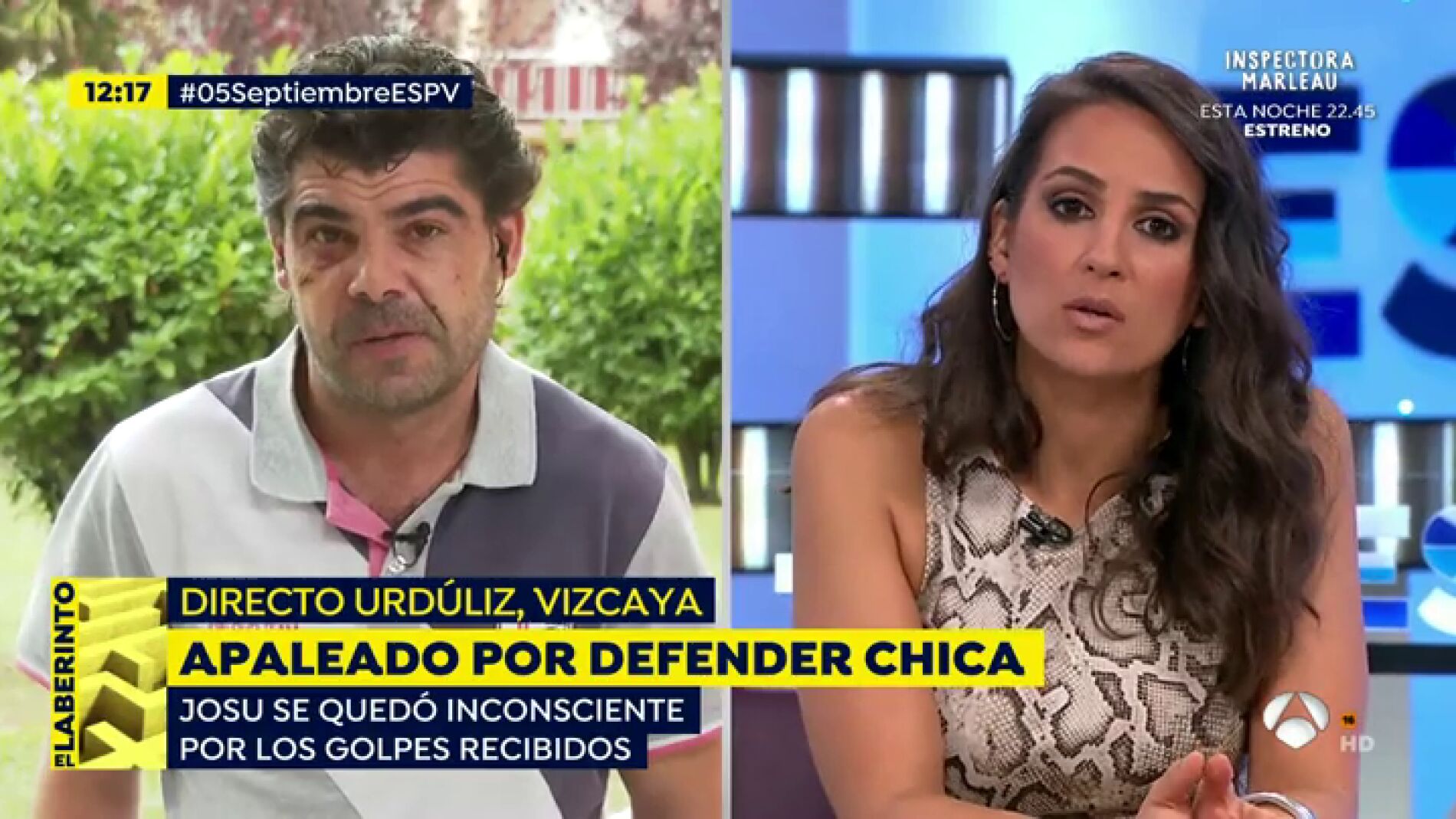 Hombre apaleado por defender a dos chicas en Vizcaya
