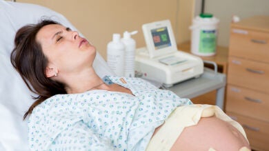 Seis mitos en torno a la epidural