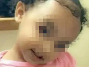 La pequeña Nalani Johnson de 23 meses. La pequeña Nalani Johnson de 23 meses.